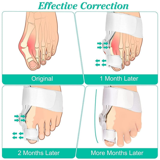 Silicone Toe Separator for Adults | Bunion Corrector Splint Kit