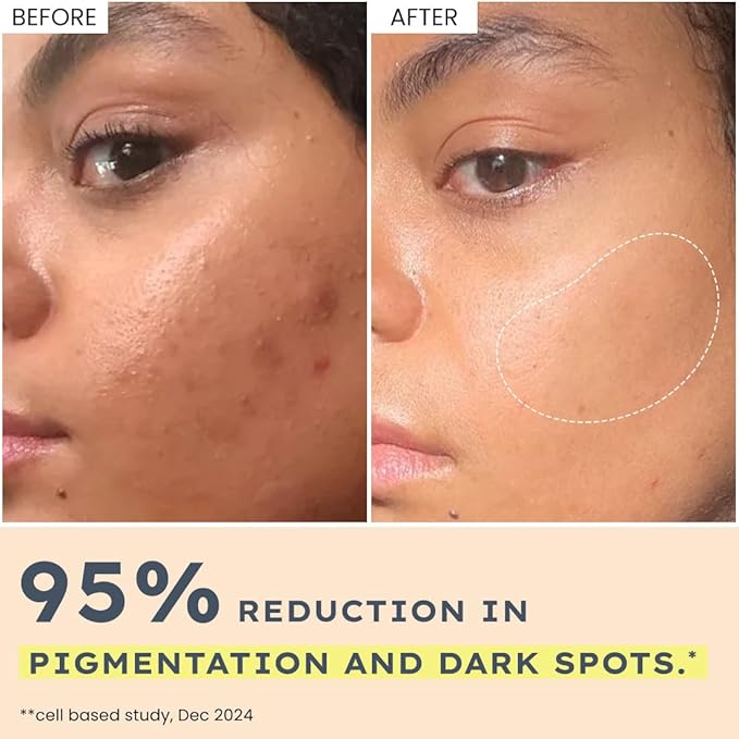 44% Rice Water Brightening Serum Pads – Glow & Hydrate