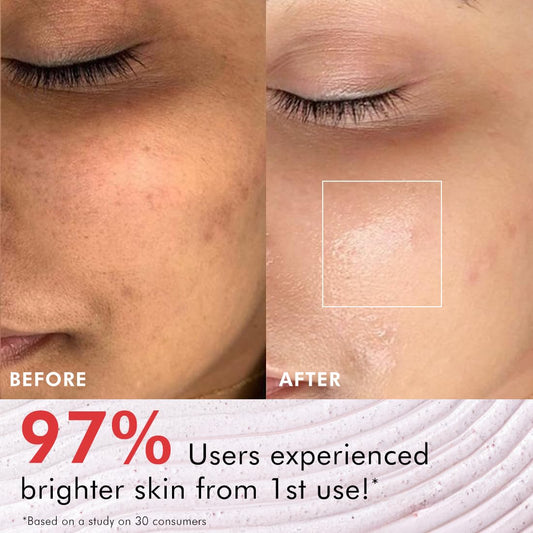 Berries Brightening Coffee Face Scrub | Gentle Exfoliation with Strawberry, Raspberry & Coffee