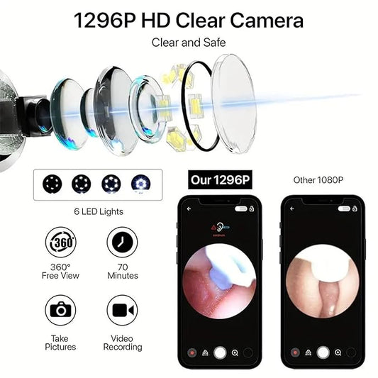 Smart WiFi Ear Wax Removal Camera | HD Otoscope with LED Lights